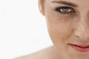 Consejos para evitar las manchas en la piel
